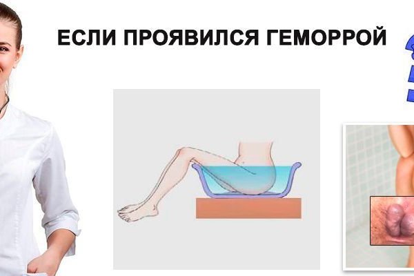 Кракен даркнет отзывы